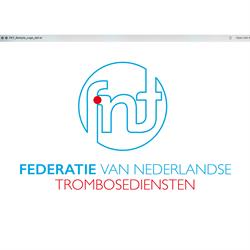 Federatie van Nederlandse Trombosediensten, Leiden openingstijden