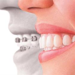 Boxberger tandartsen en orthodontie, Deventer openingstijden