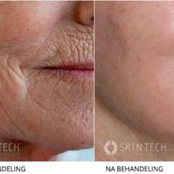 A new skin, Groesbeek openingstijden