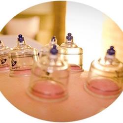 Hijama & Cupping Schiedam, openingstijden