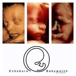 Echoburo Babywatch, IJmuiden openingstijden