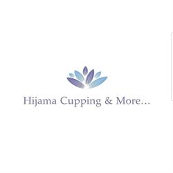 Hijama en Cupping Almelo, openingstijden