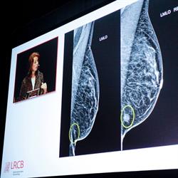 LRCB dutch expert centre for screening, Nijmegen openingstijden