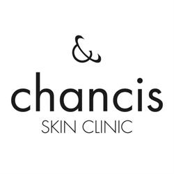 Chancis, Bergen openingstijden