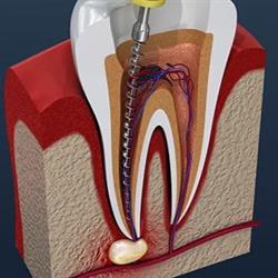 Praktijk voor Endodontologie Bergen op Zoom, openingstijden