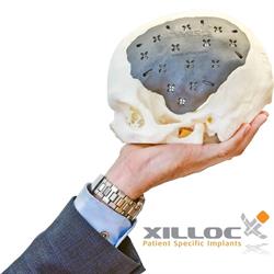 Xilloc Medical Int B.V., Geleen openingstijden