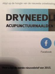 DryNeedle, Arnhem openingstijden