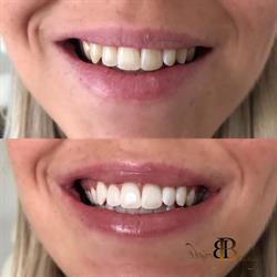 BrightSmile Praktijk, Uden openingstijden