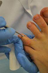 Opleiding medisch pedicure, Nijmegen openingstijden
