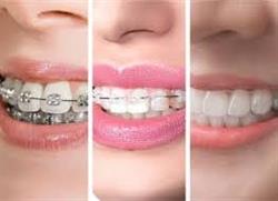 Dentaligns-Orthodontie Deventer, openingstijden